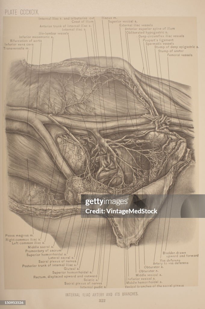 Internal Iliac Artery & Its Branches