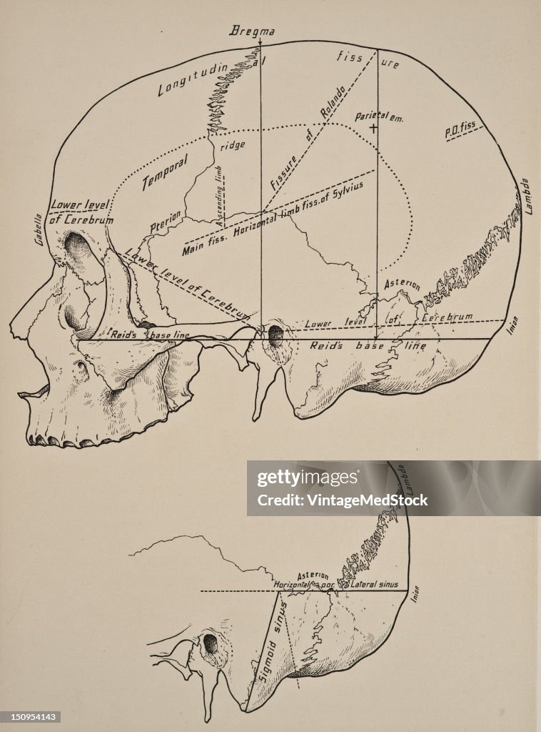 Cranial Landmarks & Lines Of Cerebral Fissures