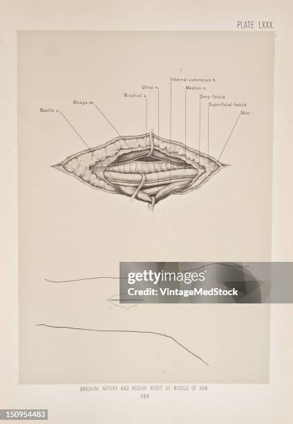 The brachial artery is the continuation of the axillary artery, and begins a the lower edge of the tendon of the teres major muscle, 1899. From 'The...