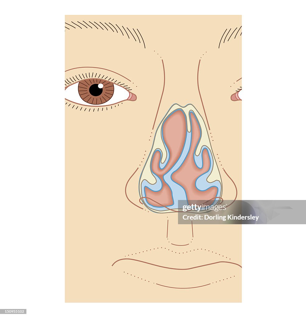 Sept Nazal Cross Section Biomedical Illustration Of Nasal Septum Deviation Closeup ...