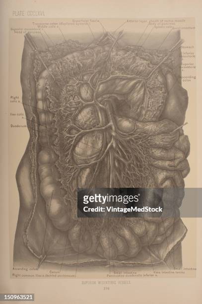 The superior mesenteric vessel is a blood vessel that drains blood from the small intestine , 1903. From 'Surgical Anatomy: The Treatise of the Human...