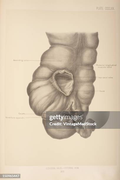 The ileo-cecal valve guards the orifice of communication between the ileum and colon and prevents regurgitation from the colon to the ileum, 1903....