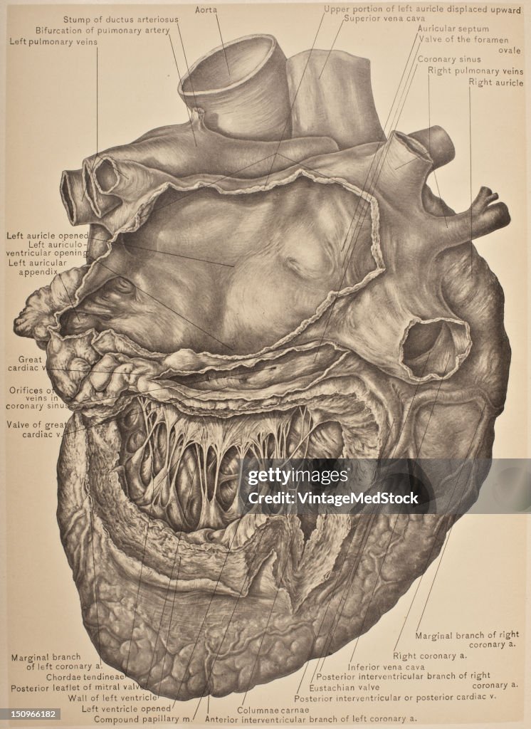 Left Auricle & Ventricle