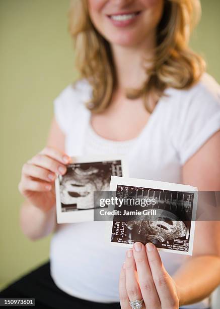 pregnant woman showing sonograms - twin ultrasound stock pictures, royalty-free photos & images