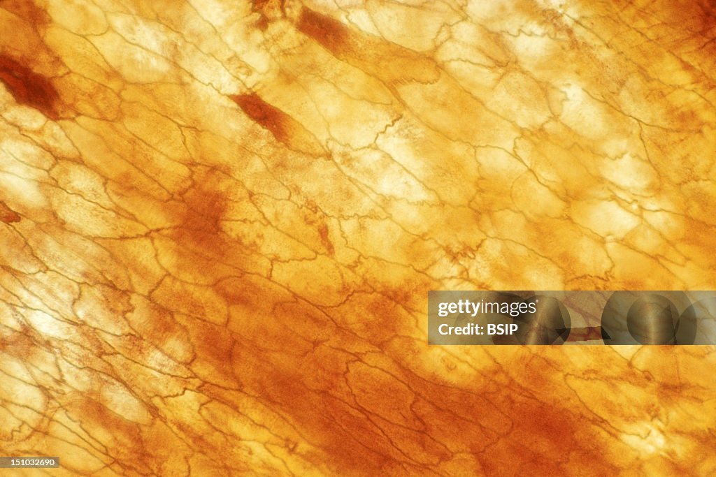 Peritoneum, Histology