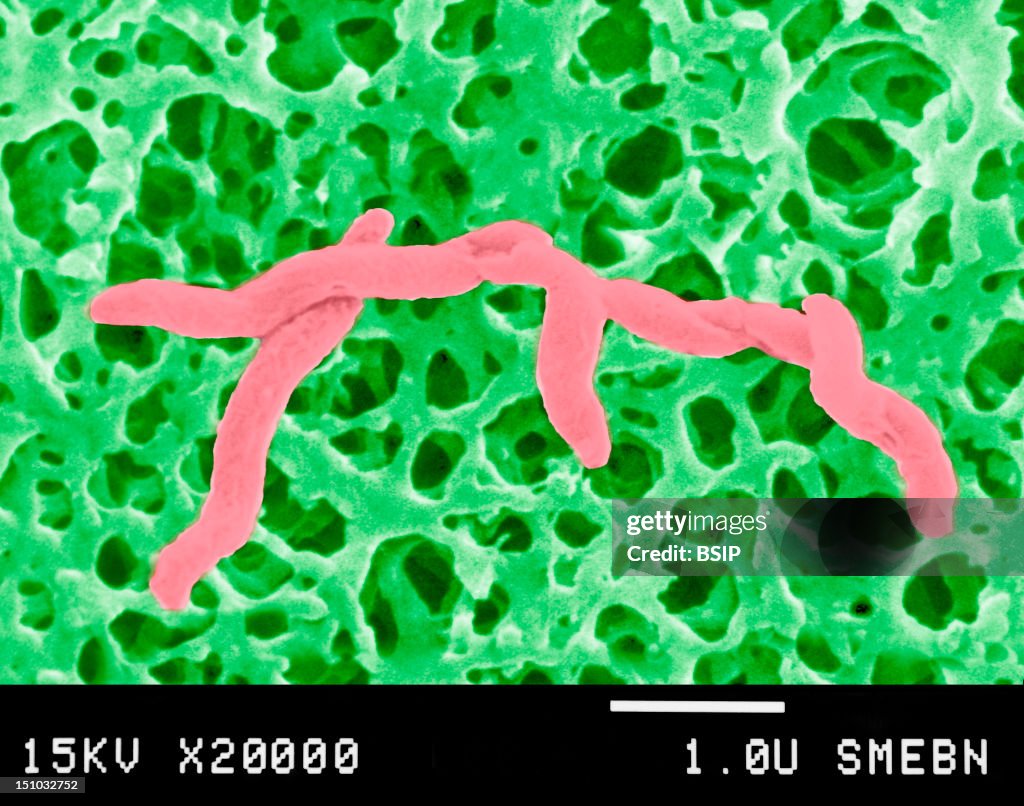 Campylobacter Jejuni