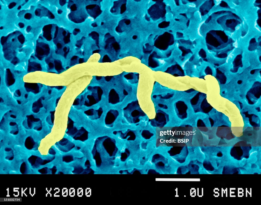Campylobacter Jejuni