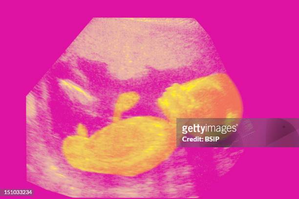 Week Old Fetus, The Mouth Is Open Sagittal Section.