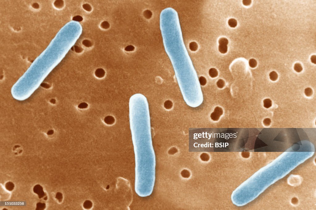 Salmonella Typhimurium