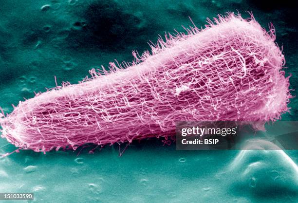 Sheep Liver Fluke Larva