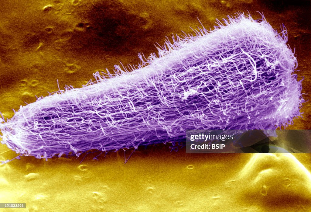 Sheep Liver Fluke Larva