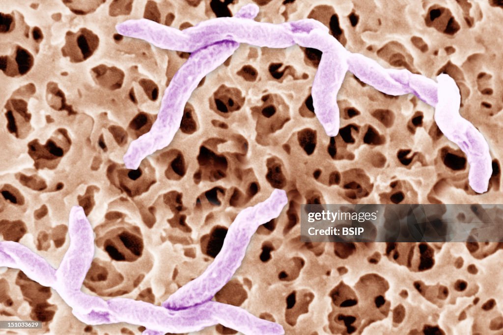 Campylobacter Jejuni