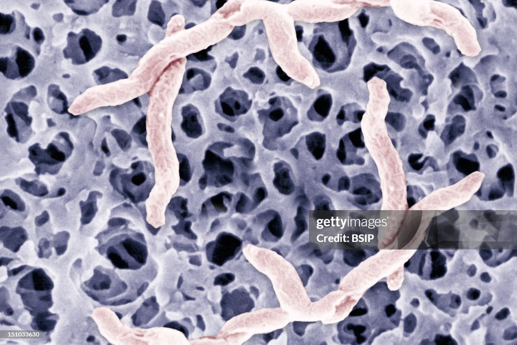 Campylobacter Jejuni
