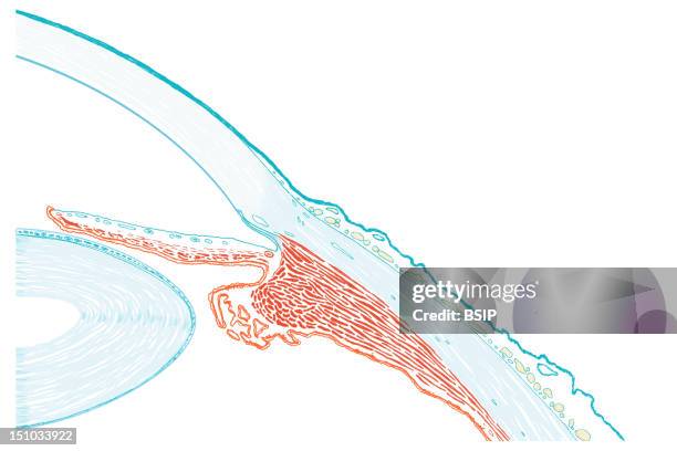 Transversal Cut Away View Of A Healthy Eye, As If It Was Viewed Under Microscope. We Can See The Relief Of The Corona Ciliaris, That Move Forward...