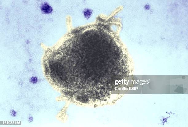 This Electron Micrograph Reveals Both A Paramyxovirus Measles Virus, And Virions Of The Polyomavirus, Simian Virus Sv40 Smaller Circles. The Envelope...