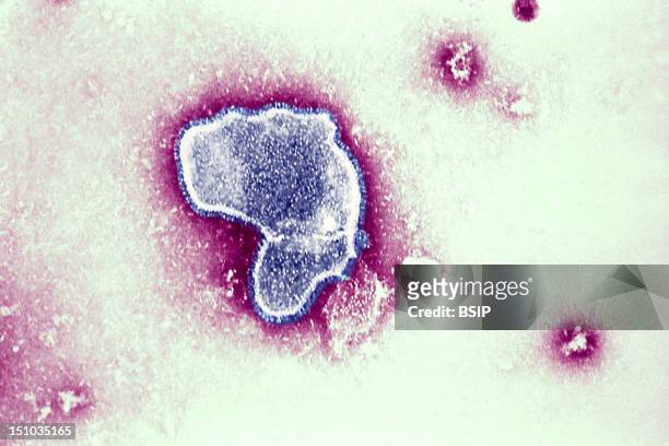 Thic Electron Micrograph Reveals The Morphologic Traits Of The Respiratory Syncytial Virus Rsv. The Virion Is Variable In Shape, And Size Average...