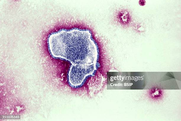 Thic Electron Micrograph Reveals The Morphologic Traits Of The Respiratory Syncytial Virus Rsv. The Virion Is Variable In Shape, And Size Average...