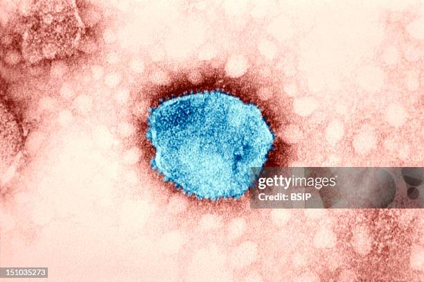 Tacaribe Complex New World Arenaviruses. Electron Micrograph Of Arenaviridae. Arenaviridae Are Rna Viruses Whose Particles Are Spherical And Have An...