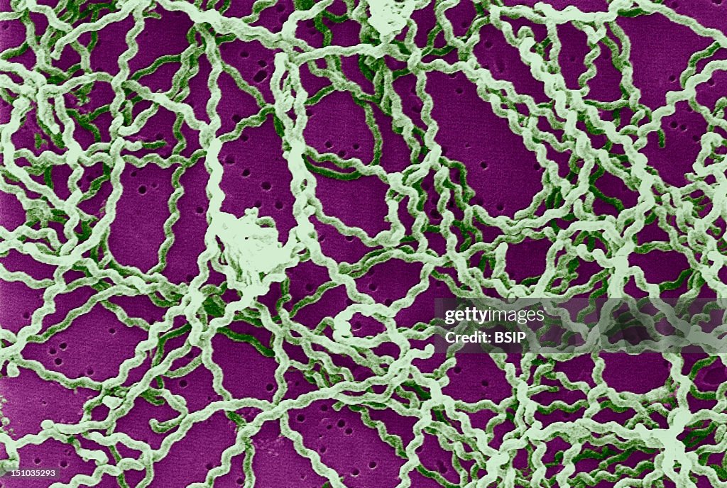 Leptospira, Sem