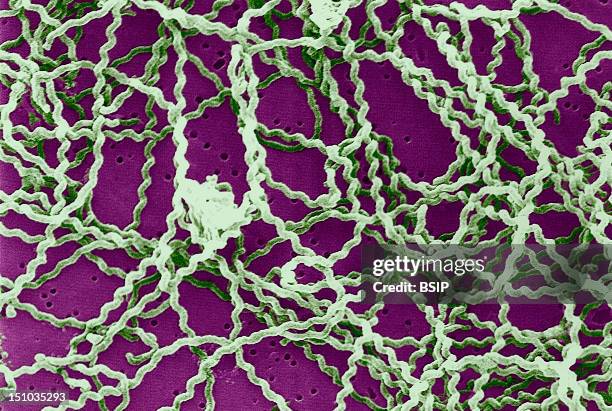 Scanning Electron Micrograph Of Leptospira Bacteria On 0. 1 ?m Polycarbonate Filter. Leptospira Is Known To Cause The Infectious Disease...