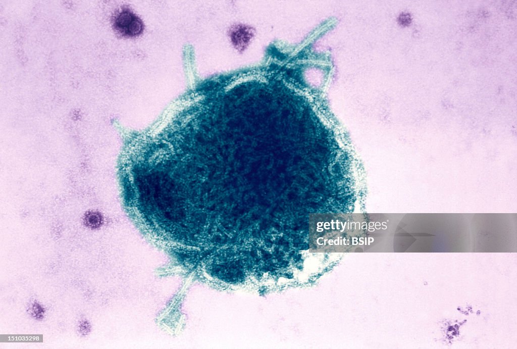 Paramyxoviridae Virus