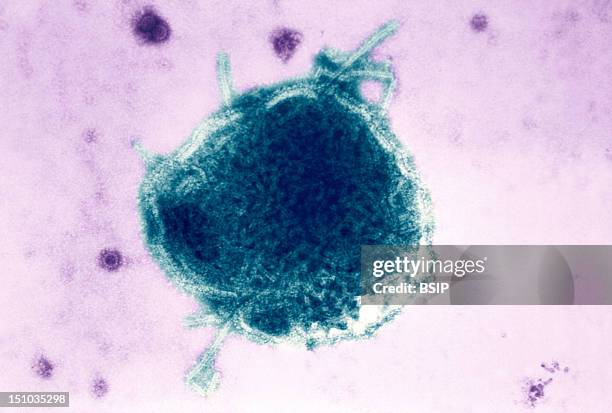 This Electron Micrograph Reveals Both A Paramyxovirus Measles Virus, And Virions Of The Polyomavirus, Simian Virus Sv40 Smaller Circles. The Envelope...