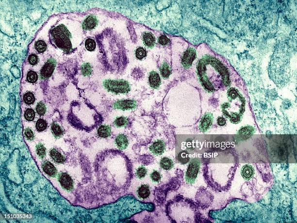 Electron Micrograph Of The Marburg Virus. Marburg Virus, First Recognized In 1967, Causes A Sever Type Of Hemorrhagic Fever, Which Affects Humans, As...
