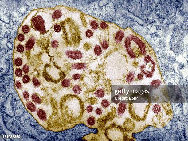 Electron Micrograph Of The Marburg Virus. Marburg Virus, First Recognized In 1967, Causes A Sever Type Of Hemorrhagic Fever, Which Affects Humans, As...