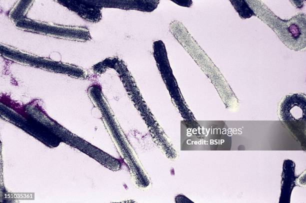 This Electron Micrograph Depicts A Number Of Marburg Virions Responsible For Causing Marburg Hemorrhagic Fever. Marburg Hemorrhagic Fever Is Caused...