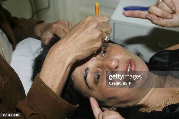 Marking The Skin Before A Botox Injection.