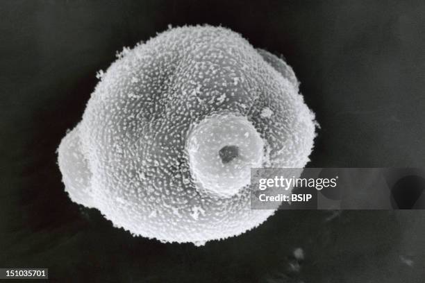 Birch Pollen, Viewed Under Sem.