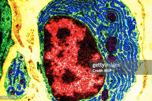 The Cytoplasm Of Fibroblasts Contain Organelles Producing An Abundant Membranous Network, The Endoplasmic Reticulum In Green Bordered By Ribosomes...