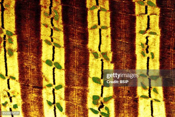 Relaxed Striated Muscle Fiber. Striated Muscles Derive Their Name From The Alternating Light Colored Bands In Yellow, Containing Thin Filaments Actin...