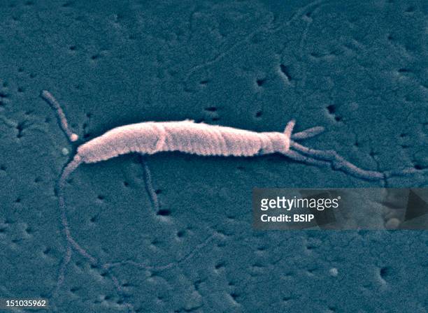 This Scanning Electron Micrograph Depicts A "Flexispira Rappini" Bacterium, Magnified 13,951X. First Described As "Flexispira Rappini", This...