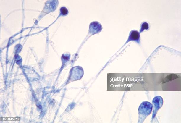 This Photomicrograph Reveals A Number Of Young Sporangia Of A Mucor Spp. Fungus. Mucor Is A Common Indoor Mold, And Is Among The Fungi That Cause The...