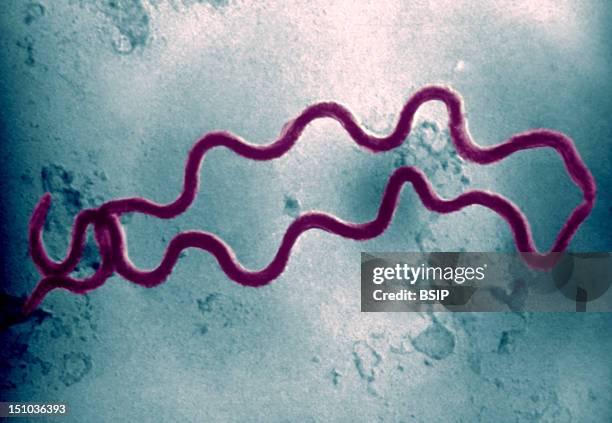 An Electron Photomicrograph Of Two Spiral Shaped Treponema Pallidum Bacteria. Here We See Two Treponema Pallidum Bacteria Scanned By An Electron...
