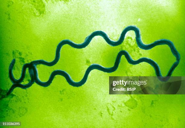 An Electron Photomicrograph Of Two Spiral Shaped Treponema Pallidum Bacteria. Here We See Two Treponema Pallidum Bacteria Scanned By An Electron...