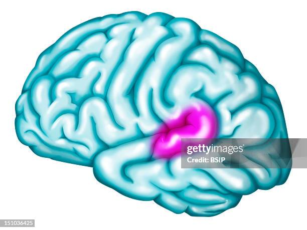 Wernicke's Area. Location Of The Wernicke's Area In Purple In The Left Hemisphere. Wernicke's Area Is Part Of The Auditory Cortex And Participates To...