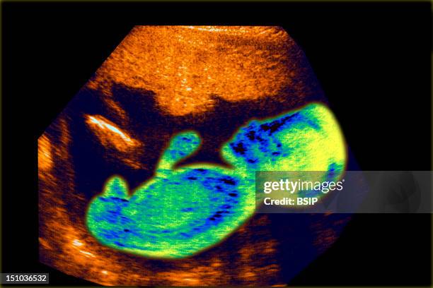 Week Old Fetus. Sagittal View.