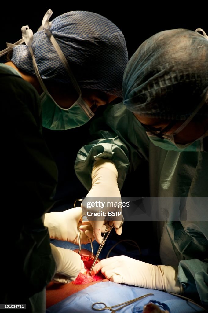Myomectomy