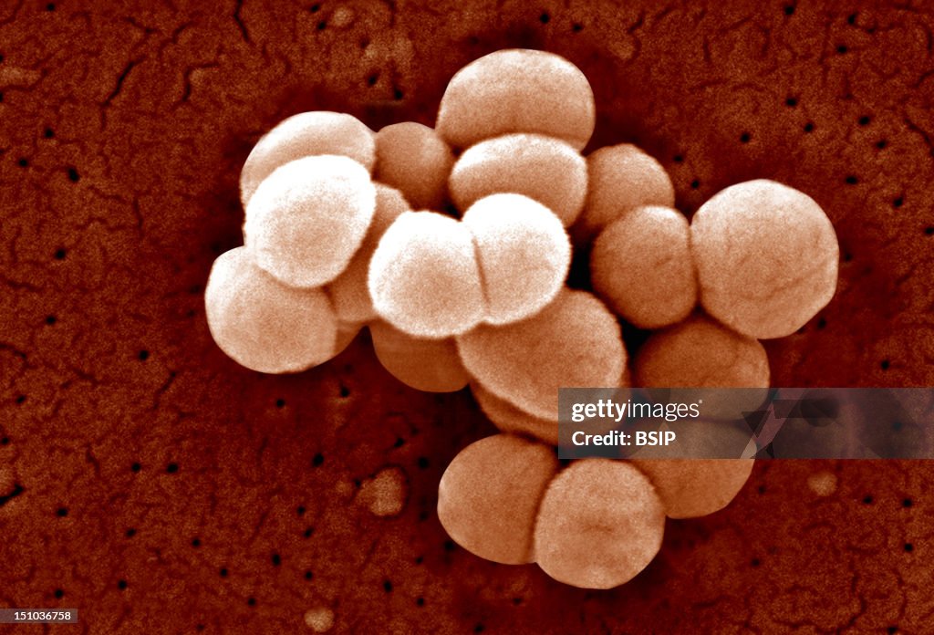 Leteus Microscope Micrococcus Luteus, Scanning Electron Micrograph Colorized Sem, X 21 ...
