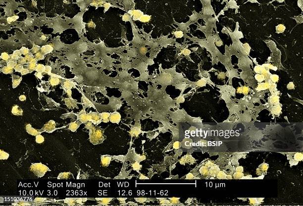 Staphylococcus Aureus In Biofilm, Coming From The Inside Of A Permanent Urinary Catheter Colorized Sem, X 2 363, The Bar Represents 10 Microns. A...