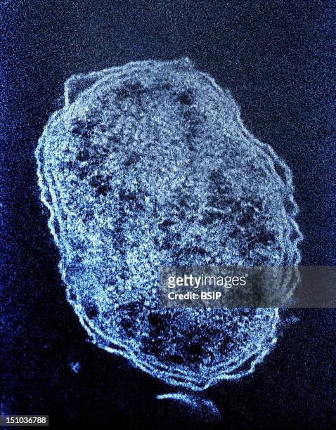 Bacterium Orientia Tsutsugamushi Colorized Tem. This Bacterium Is Recovered Of A Cellular Membrane Coming From The Host Cell Mesothelial Origin Of...