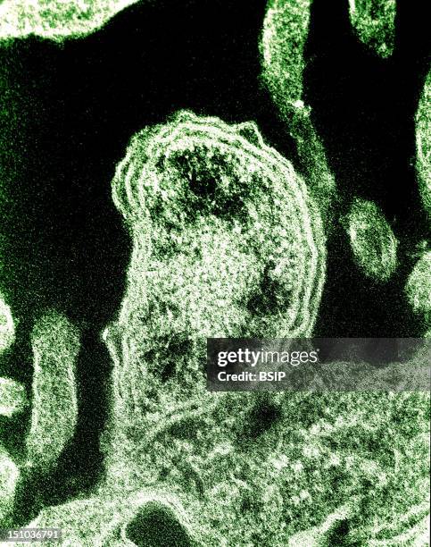 Bacterium Orientia Tsutsugamushi Budding From Its Host Cell Peritoneal Mesothelial Cell, Colorized Tem. This Specimen Comes From The Peritoneal...