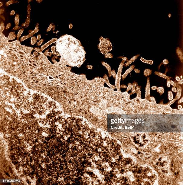Bacterie Orientia Tsutsugamushi Bourgeonnant De Sa Cellule Hote Cellule Endotheliale D'Un Vaisseau Sanguin Du Cerveau, Met Colorise. Ce Specimen...