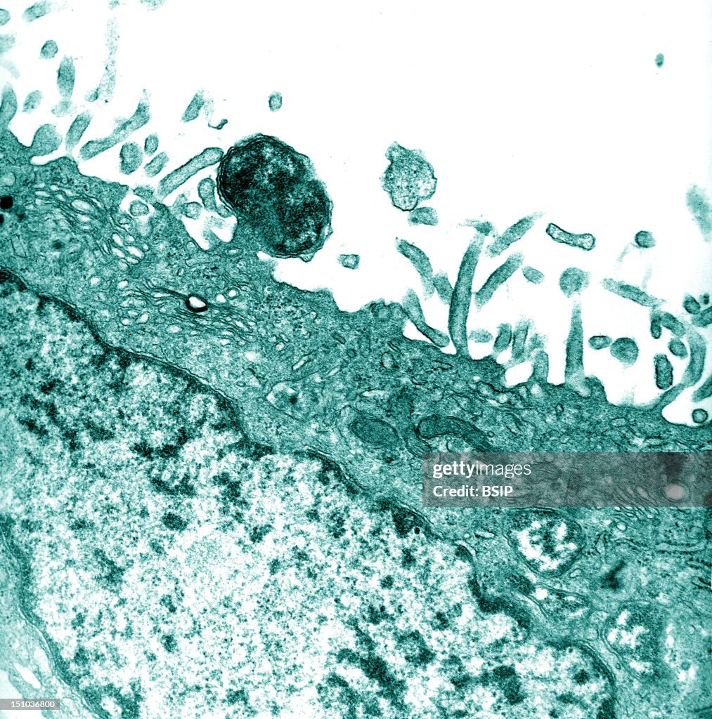 Orientia Tsutsugamushi