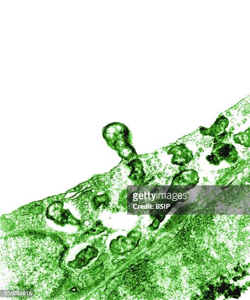 Bacterium Orientia Tsutsugamushi Budding From Its Host Cell Peritoneal Mesothelial Cell, Colorized Tem. This Specimen Comes From The Peritoneal...