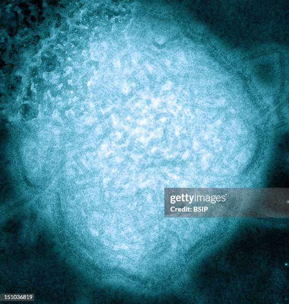 Mumps Virus Colorized Temmumps Virus > Rubulavirus > Paramyxoviridae > Rna Virus > Virus. This 1973 Negative Stained Transmission Electron Micrograph...