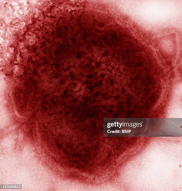 Mumps Virus Colorized Temmumps Virus > Rubulavirus > Paramyxoviridae > Rna Virus > Virus. This 1973 Negative Stained Transmission Electron Micrograph...