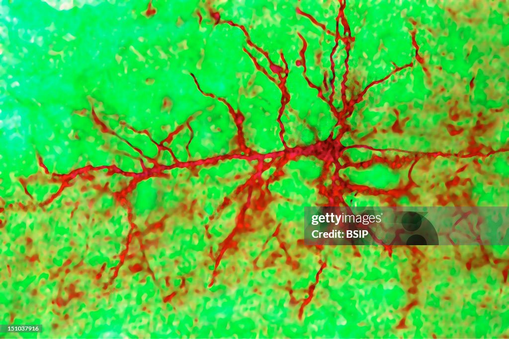 Neuron